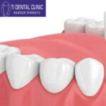 Group logo of Dental Implants: Bridging Gaps, Building Confidence